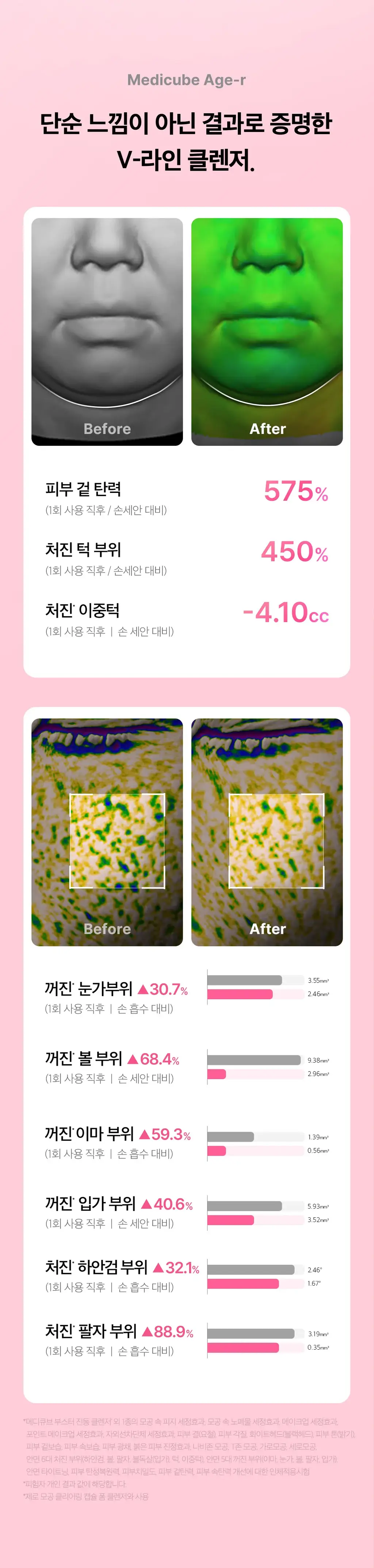 [한교동 에디션] 메디큐브 에이지알 부스터 진동 클렌저 한교동 기획 (+미니플러스, 클렌징 헤드, 폼클렌저, 세안밴드) 상세페이지 47